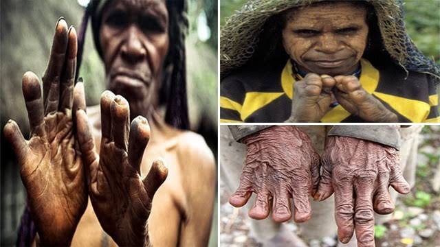 أبرزها "العيش مع الموتى" و " وقطع أصابع النساء".. عادات القبائل الإندونيسية