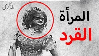 المرأة القرد.. ظاهرة فريدة من نوعها في العالم